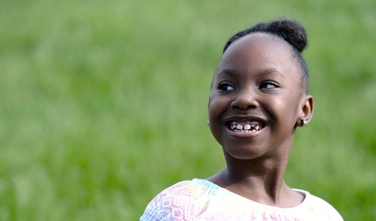 diastrophic dysplasia facts